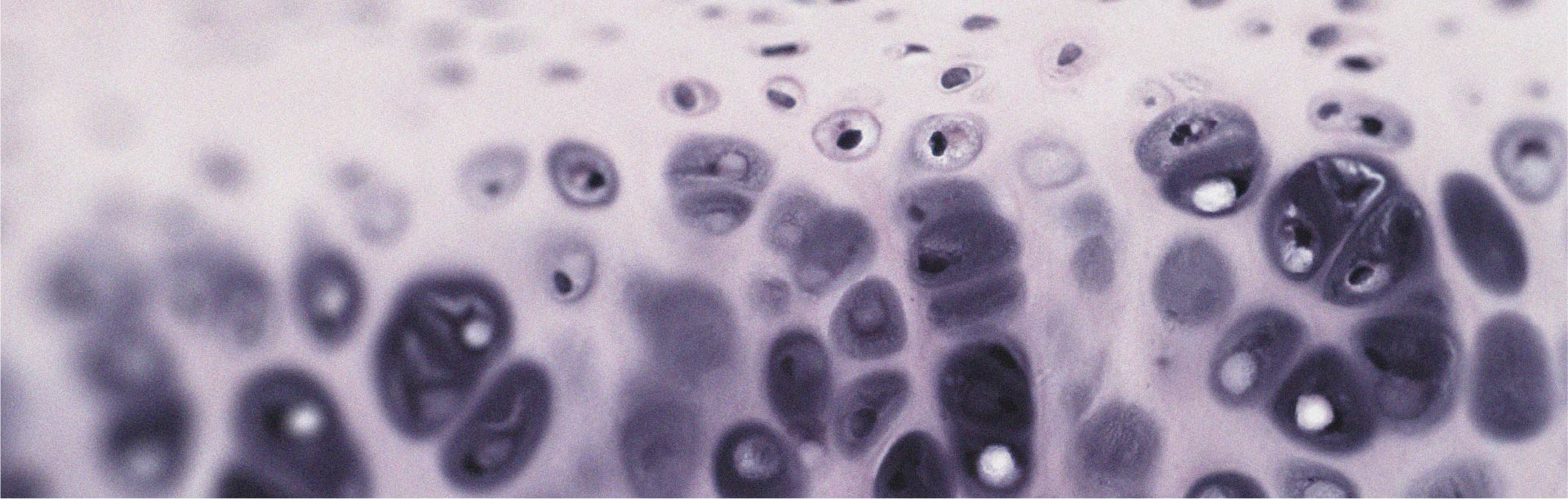 How collagen may help relieve knee osteoarthritis