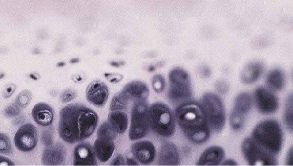 How collagen may help relieve knee osteoarthritis