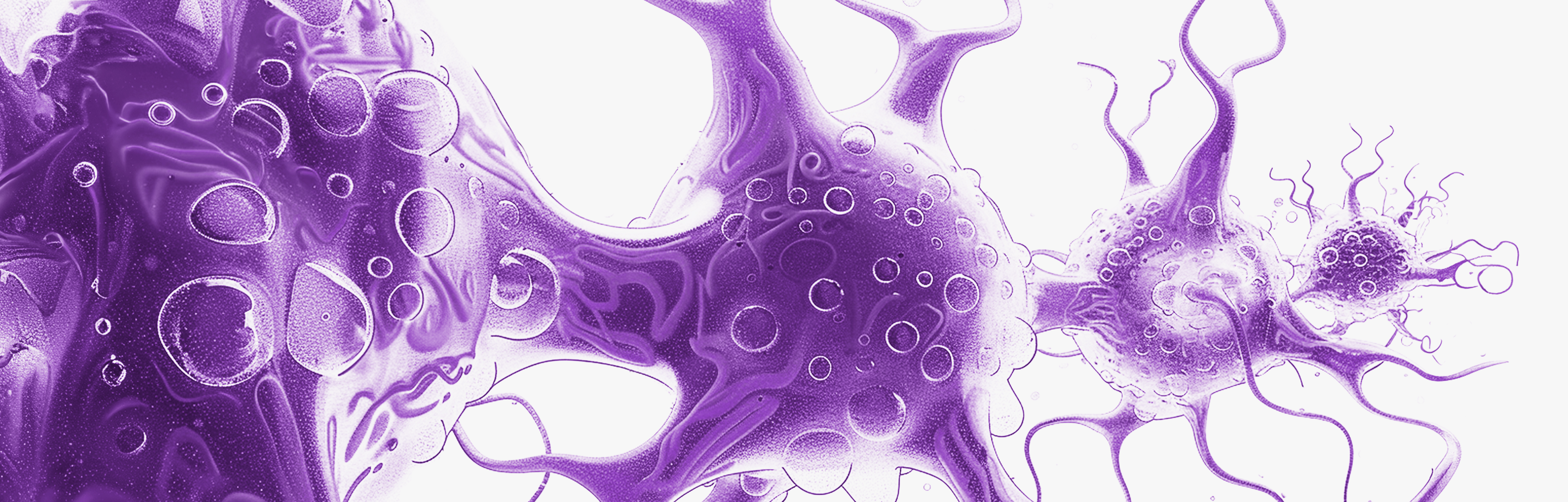 Hands protecting a brain